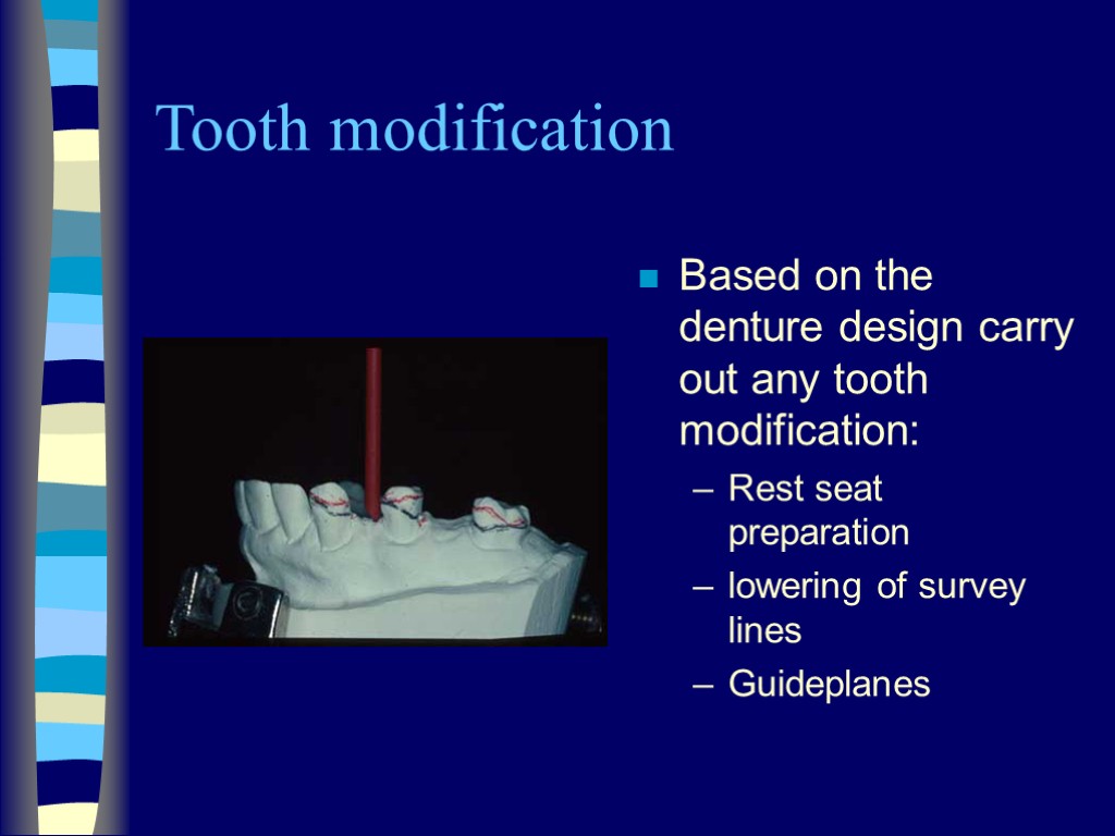 Tooth modification Based on the denture design carry out any tooth modification: Rest seat